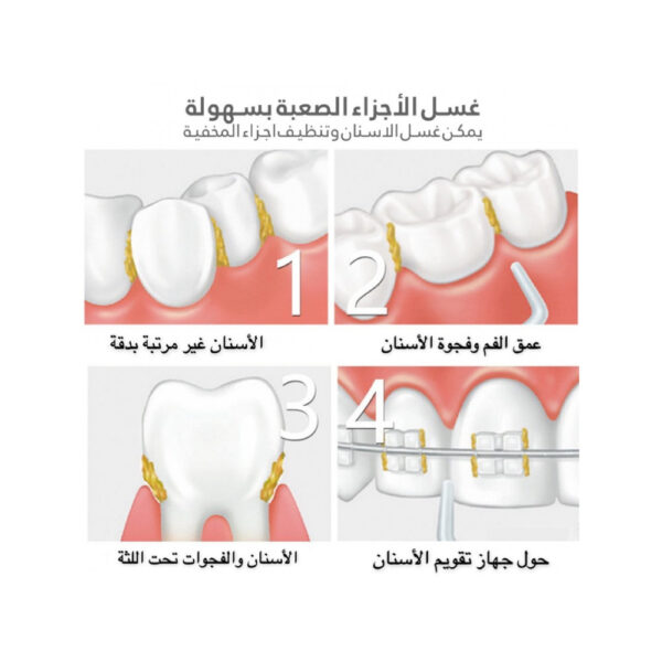 ⁦داش جهاز الخيط المائي المطور لتنظيف الاسنان المحمول، 5 سرعات، خزان ماء 300 مل+6 رؤوس وحقيبة⁩ - الصورة ⁦4⁩
